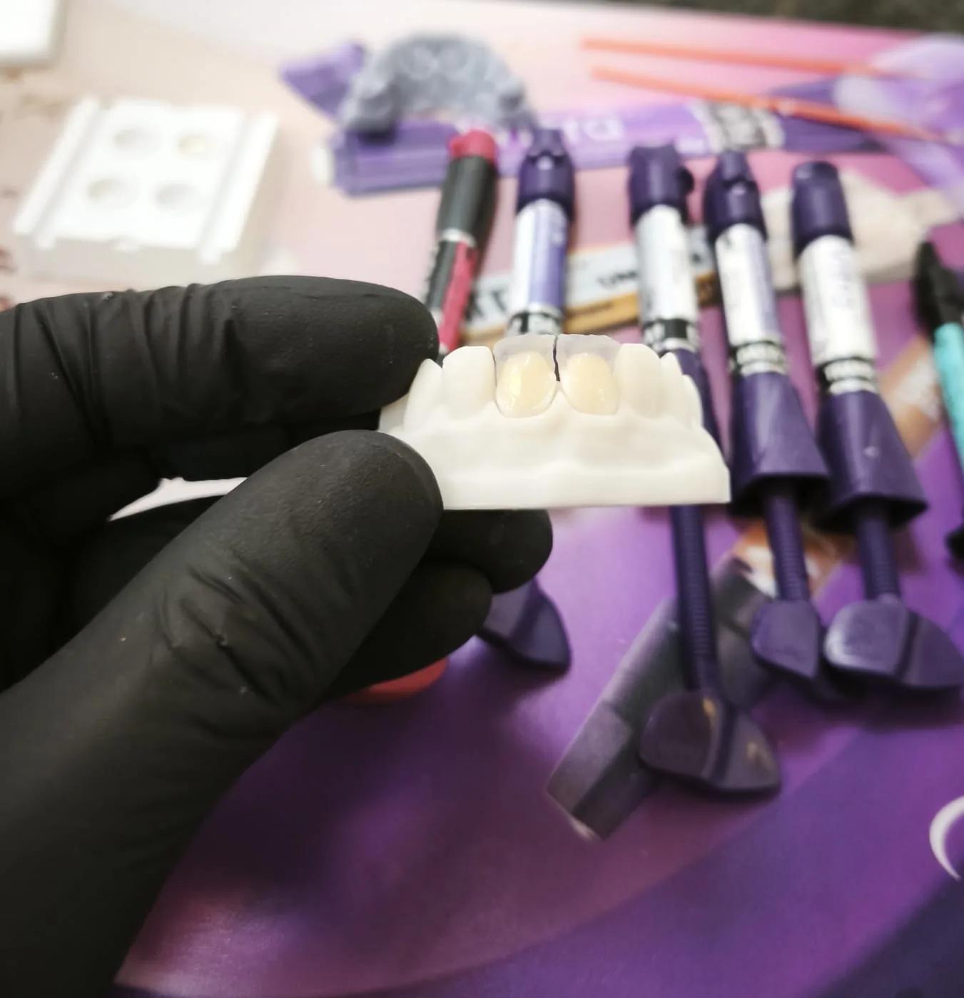 Trabajo clínico de rehabilitación dental